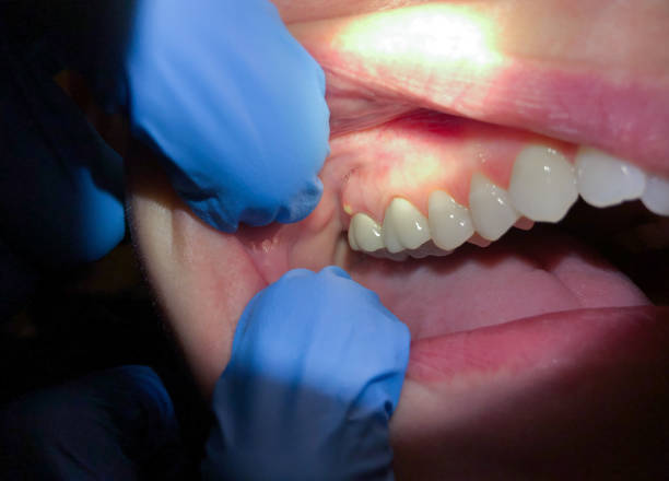 Best Broken Tooth Emergency  in Enterprise, WV